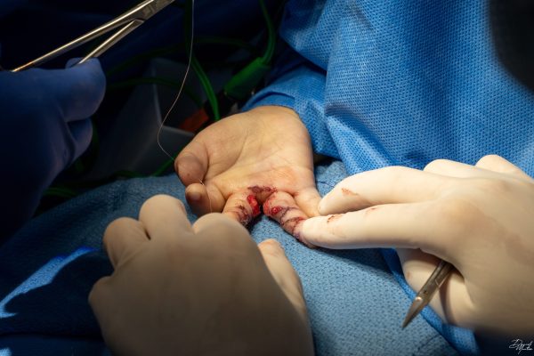 Surgery 2